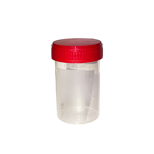 Vizeletes pohár tetővel, steril - 60 ml, 1x